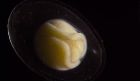  Dictyostelium! Un Amoebozoaire Fascinant Qui Transforme la Cellule Solitaire en Société Intelligente